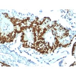 p53 Tumor Suppressor Protein (TP53/1799R), CF640R conjugate, 0.1mg/mL