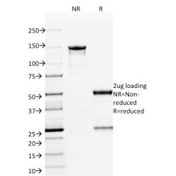 ETS1 (Marker of Tumor Metastasis)(ETS1/1801), CF640R conjugate, 0.1mg/mL