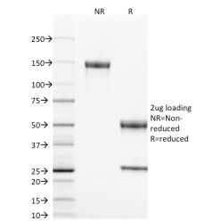 Biotium BNC401802-500, CD40 / TNFRSF5 / CD40L-Receptor(T8P2G4*A6), CF640R conjugate, 0.1mg/mL