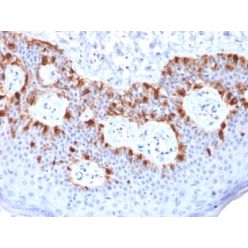 MART-1 / Melan-A / MLANA (Melanoma Marker) (rMLANA/788), CF640R conjugate, 0.1mg/mL
