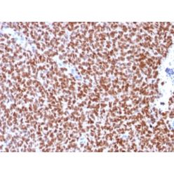 NKX2.2 (Neuroendocrine &amp; Ewing s Sarcoma Marker) (rNX2/294), CF640R conjugate, 0.1mg/mL