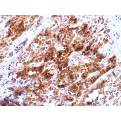 Glypican-3 (GPC3) (Hepatocellular Carcinoma Marker) (rGPC3/863), CF640R conjugate, 0.1mg/mL