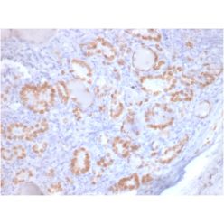 TTF-1 / NKX2.1 (Thyroid & Lung Epithelial Marker) (rNX2.1/690), CF640R conjugate, 0.1mg/mL