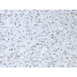 Wilm s Tumor 1 (WT1) (Wilm s Tumor &amp; Mesothelial Marker) (rWT1/857), CF640R conjugate, 0.1mg/mL
