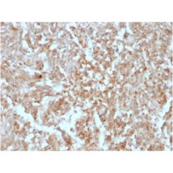 DOG-1 / TMEM16A (Gastrointestinal Stromal Tumor Marker)(rDG1/447), CF640R conjugate, 0.1mg/mL