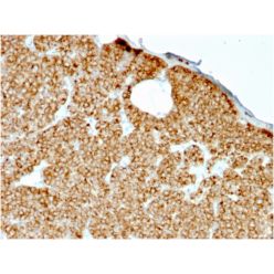 Parathyroid Hormone (PTH) (N-Terminal)(rPTH/911), CF640R conjugate, 0.1mg/mL