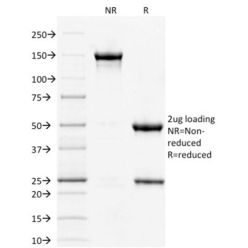 STAT3 / Signal Transducer and Activator of Transcription 3 (PCRP-STAT3-2F12), CF640R conjugate, 0.1mg/mL