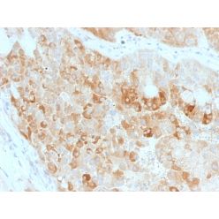 ROR2(ROR2/1911), CF640R conjugate, 0.1mg/mL