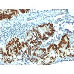 p53 Tumor Suppressor Protein(PAb1801), CF640R conjugate, 0.1mg/mL