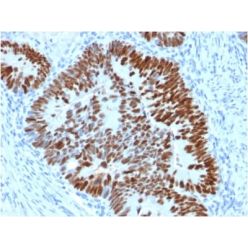 p53 Tumor Suppressor Protein (PCRP-TP53-2A10), CF640R conjugate, 0.1mg/mL