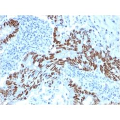 p53 Tumor Suppressor Protein (PCRP-TP53-1F7), CF640R conjugate, 0.1mg/mL