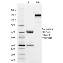SOX9 / SRY-box 9 (PCRP-SOX9-1E5), CF640R conjugate, 0.1mg/mL