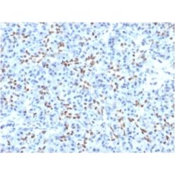 SOX9 / SRY-box 9 (PCRP-SOX9-1A2), CF640R conjugate, 0.1mg/mL