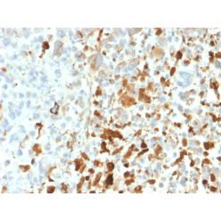 Vimentin (Mesenchymal Cell Marker)(VIM/1937R), CF640R conjugate, 0.1mg/mL