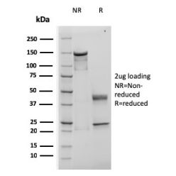 TIMP1 (Colorectal Cancer Biomarker / Marker of Lymph Node Metastasis)(rTIMP1/1710), CF640R conjugate, 0.1mg/mL