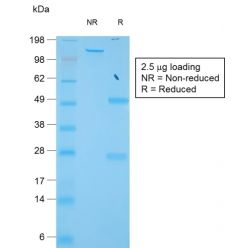 TIMP1 (Colorectal and Lymph Node Metastasis Marker)(TIMP1/1944R), CF640R conjugate, 0.1mg/mL