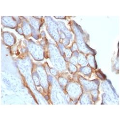 HCG-beta (Pregnancy & Choriocarcinoma Marker)(HCGb/1996R), CF640R conjugate, 0.1mg/mL