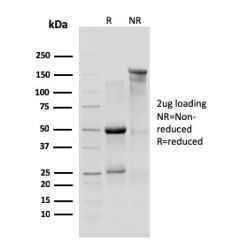 IL-10R1, Mouse (Interleukin-10 Receptor 1) (CD210)(1B1.3a), CF640R conjugate, 0.1mg/mL