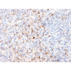 Tyrosinase (Melanoma Marker) (TYR/2024R), CF640R conjugate, 0.1mg/mL