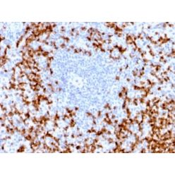 MMP9 (MMP9/2025R), CF640R conjugate, 0.1mg/mL