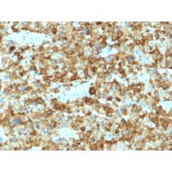gp100 / Melanosome / PMEL17 / SILV (Melanoma Marker) (PMEL/2037), CF640R conjugate, 0.1mg/mL
