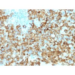 gp100 / Melanosome / PMEL17 / SILV (Melanoma Marker) (PMEL/2039), CF640R conjugate, 0.1mg/mL