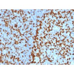 ZAP70 (Chronic Lymphocytic Leukemia Marker)(ZAP70/2047), CF640R conjugate, 0.1mg/mL