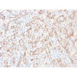 TNFS15 / VEGI (Vascular Endothelial Growth Inhibitor) (rVEGI/1283), CF640R conjugate, 0.1mg/mL