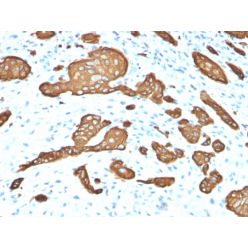 Cytokeratin 8 (KRT8)(KRT8/2115), CF640R conjugate, 0.1mg/mL