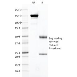 FOLH1 / PSMA (Prostate Epithelial Marker)(FOLH1/2121), CF640R conjugate, 0.1mg/mL