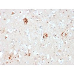 Ubiquitin (Autophagy Marker) (UBB/2122), CF640R conjugate, 0.1mg/mL