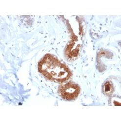 Mammaglobin (SCGB2A2) (Breast Cancer Marker) (MGB1/2123R), CF640R conjugate, 0.1mg/mL