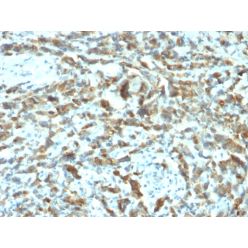 pS2 / pNR-2 / TFF1 (Estrogen-Regulated Protein)(TFF1/2133), CF640R conjugate, 0.1mg/mL