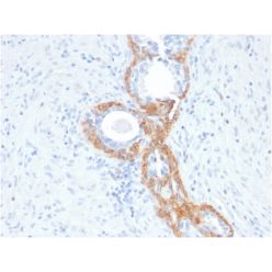 Cytokeratin, Basic (Type II or HMW)(rKRTH/2148), CF640R conjugate, 0.1mg/mL