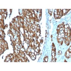 TACSTD2 / TROP2 (Epithelial Marker) (TACSTD2/2151), CF640R conjugate, 0.1mg/mL
