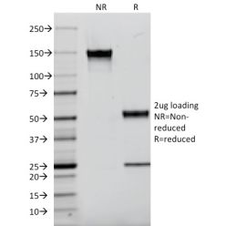 EGFR (Epidermal Growth Factor Receptor)(F4), CF640R conjugate, 0.1mg/mL
