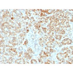 Frataxin (Marker of Friedreich Ataxia)(FXN/2124), CF640R conjugate, 0.1mg/mL