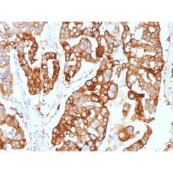 Cytokeratin 7 (Glandular and Transitional Epithelial Marker)(KRT7/2200), CF640R conjugate, 0.1mg/mL