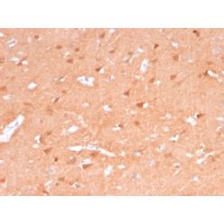 PGP9.5 / UchL1 (pan-Neuronal Marker) (rUCHL1/775), CF640R conjugate, 0.1mg/mL