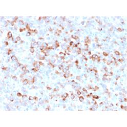 Tyrosinase (Melanoma Marker)(rOCA1/812), CF640R conjugate, 0.1mg/mL