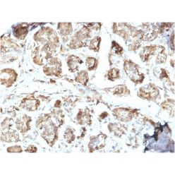 NME2 / nm23-H2 / NDPK-B (Suppressor of Metastasis)(CPTC-NME2-2), CF640R conjugate, 0.1mg/mL