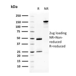 Squamous Cell Carcinoma Antigen 1(CPTC-SERPINB3-2), CF640R conjugate, 0.1mg/mL