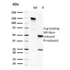Spermidine or Spermine N1-Acetyltransferase 1(CPTC-SAT1-3), CF640R conjugate, 0.1mg/mL