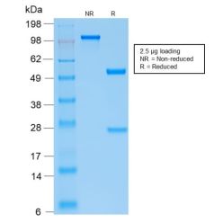 Parathyroid Hormone (PTH) (N-Terminal) (PTH/2295R), CF640R conjugate, 0.1mg/mL