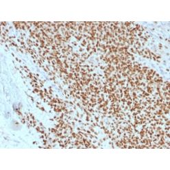 NKX2.2 (Neuroendocrine & Ewing s Sarcoma Marker) (rNX2/1523), CF640R conjugate, 0.1mg/mL