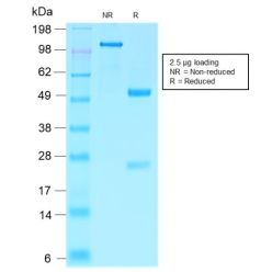 Villin (GI-Mucosal & Urogenital Brush Border Marker) (VIL1/2310R), CF640R conjugate, 0.1mg/mL