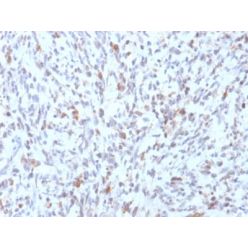 MyoD1 (Rhabdomyosarcoma Marker) (rMYD712), CF640R conjugate, 0.1mg/mL