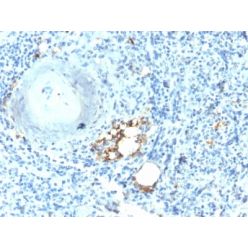TRAcP (Tartrate-Resistant Acid Phosphatase) (Hairy Cell Leukemia Marker) (ACP5/2336R), CF640R conjugate, 0.1mg/mL