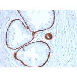 Cytokeratin 14 (KRT14) (Squamous Cell Marker)(KRT14/2375), CF640R conjugate, 0.1mg/mL