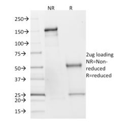 SDHB (Succinate Dehydrogenase B) (Pheochromocytoma Marker)(SDHB/2382), CF640R conjugate, 0.1mg/mL